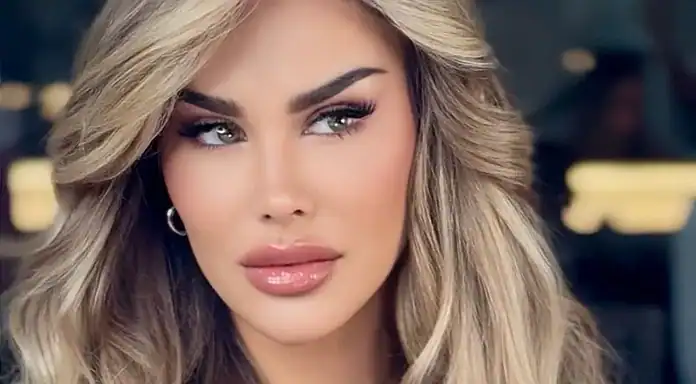 Ninel Conde se cambia color de ojos y genera preocupación
